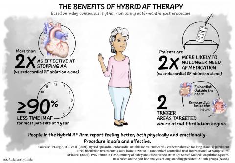 Hybrid AF Therapy Resources | Atrial Fibrillation Treatment (Afib ...